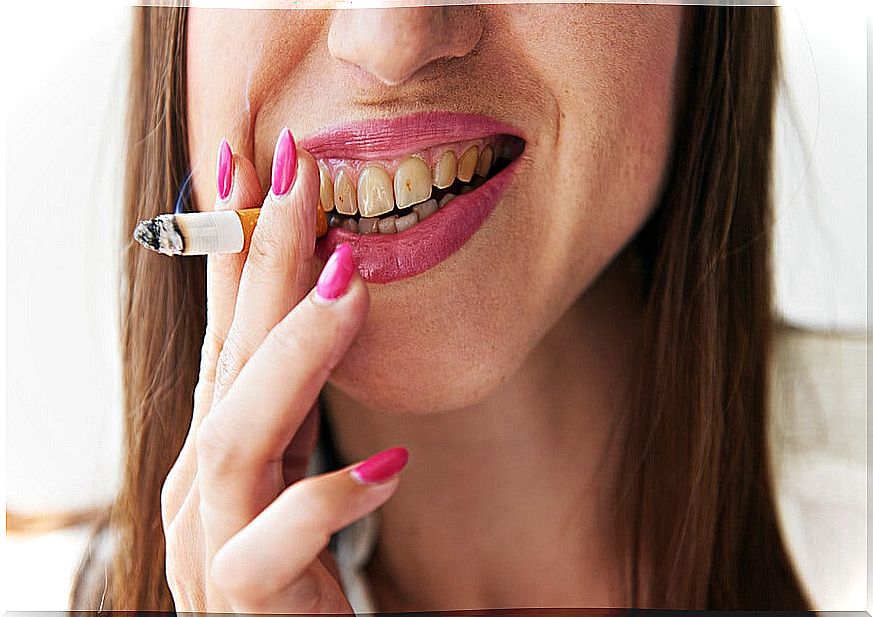 Woman revealing the damage of tobacco in the oral cavity