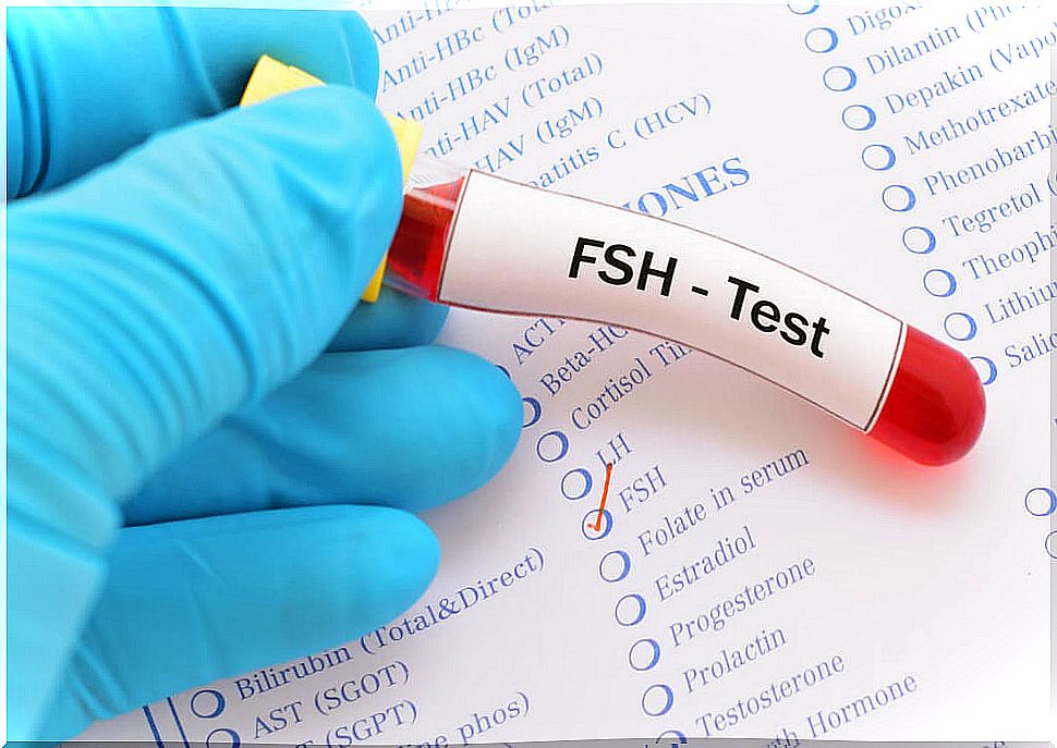 The FHS test: blood test to determine the amount of follicle-stimulating hormone.