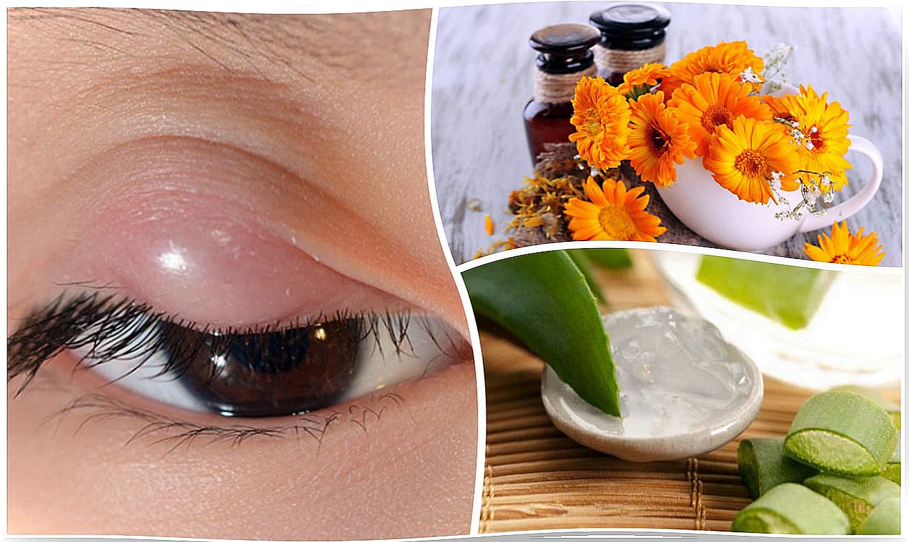 How to relieve styes with these 7 natural remedies