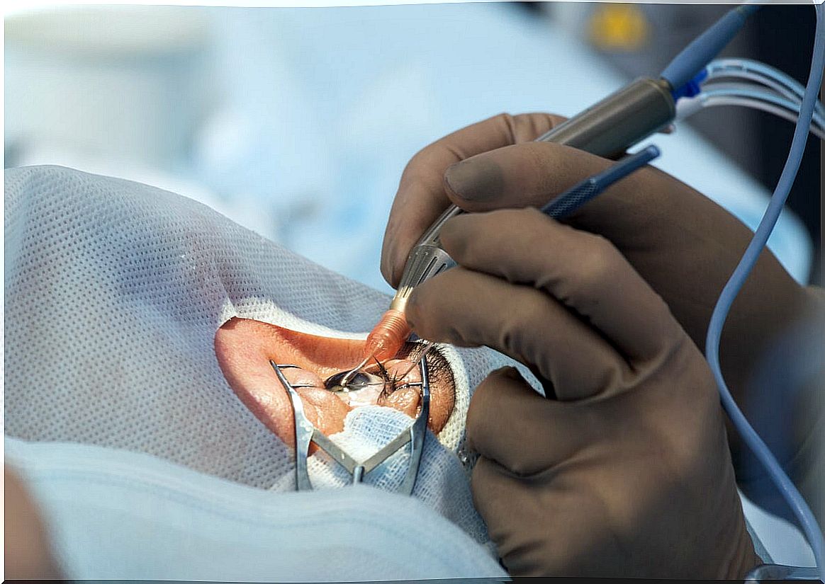 Intraocular lens placement surgery.