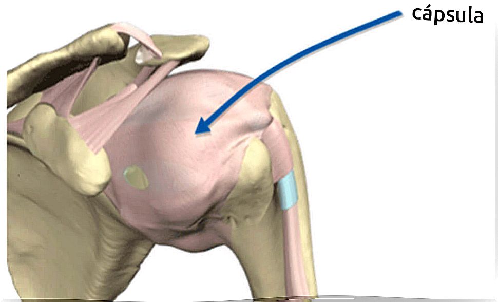 Image of a capsulitis